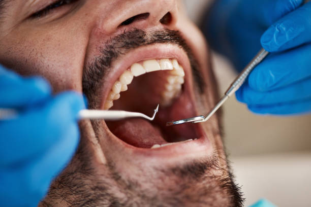 Best Emergency Gum Treatment in Maroa, IL