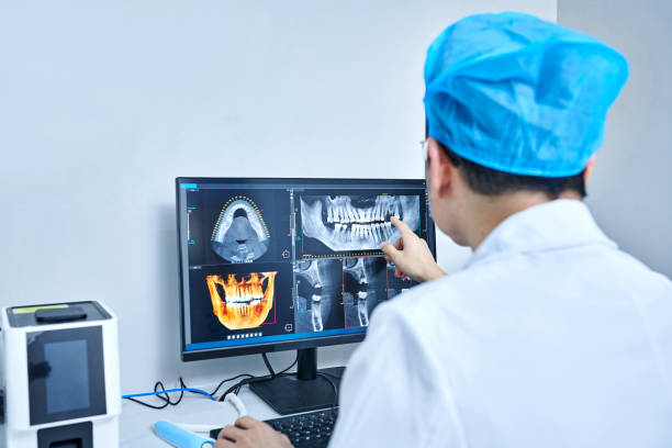 Best Emergency Wisdom Teeth Removal in Maroa, IL
