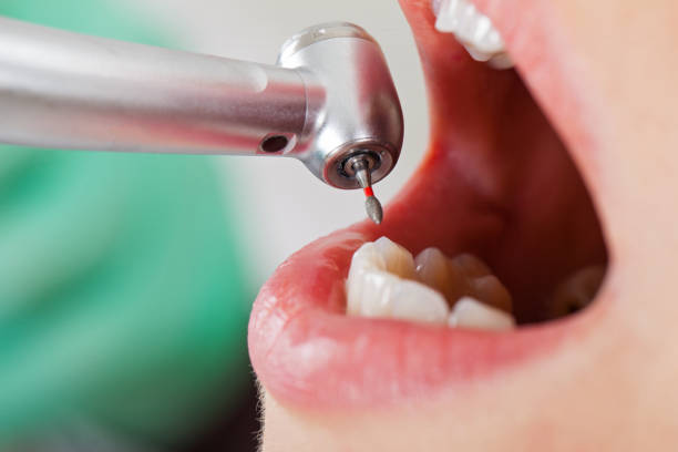 Best After-Hours Dental Trauma Care in Maroa, IL